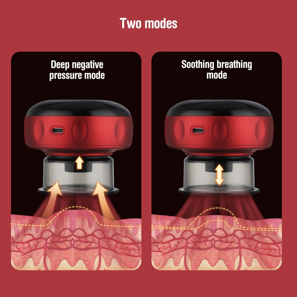 Electric Cupping Massage Device